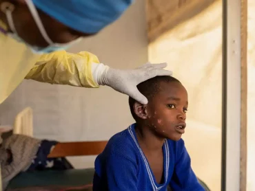 Congo Will Begin Vaccination Campaign for Mpox Next Month