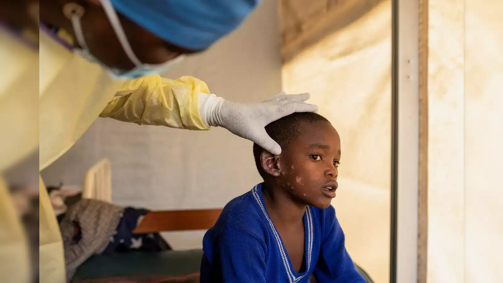 Congo Will Begin Vaccination Campaign for Mpox Next Month